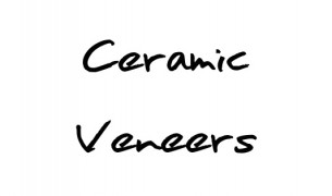 Ceramic Veneers